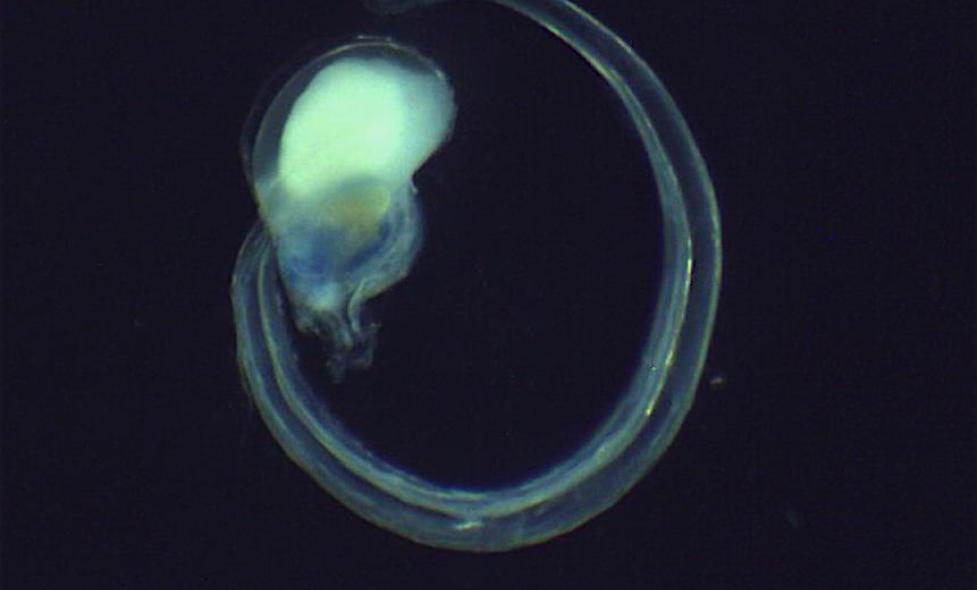 Appendiculaire - Agrandir l'image, fenêtre modale