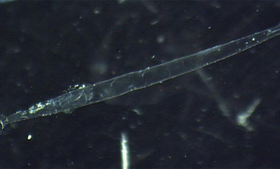 Chaetognathe - Agrandir l'image, fenêtre modale